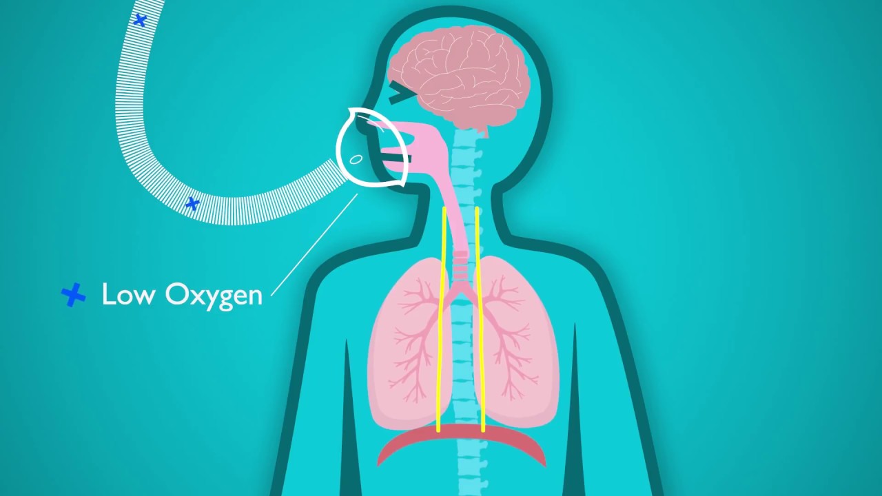 How Low Oxygen Levels Increase the Risk of Arrhythmias 9 thieu